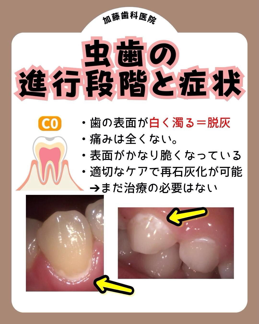 こんにちは♪加藤歯科医院です🦷