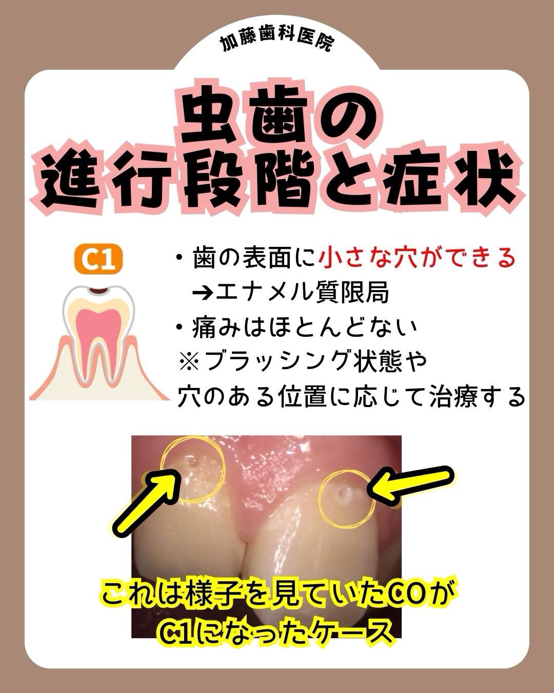 こんにちは♪加藤歯科医院です🦷