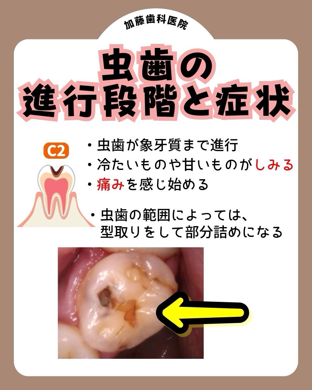 こんにちは♪加藤歯科医院です🦷