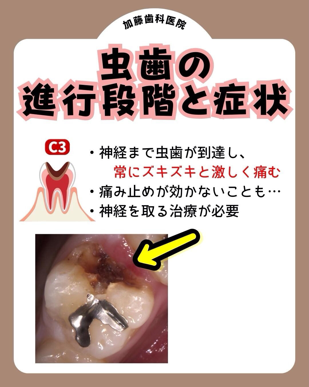 こんにちは♪加藤歯科医院です🦷
