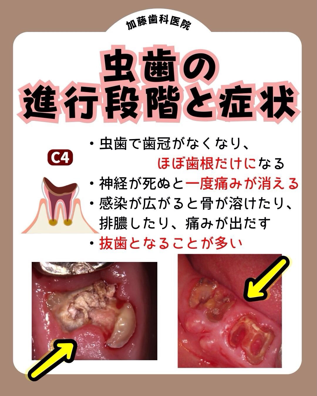 こんにちは♪加藤歯科医院です🦷