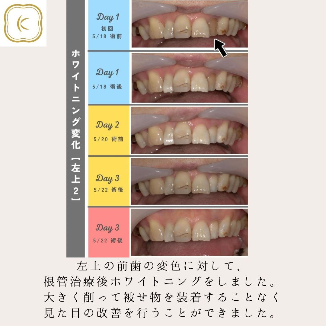 当院で行なっている治療の紹介をします