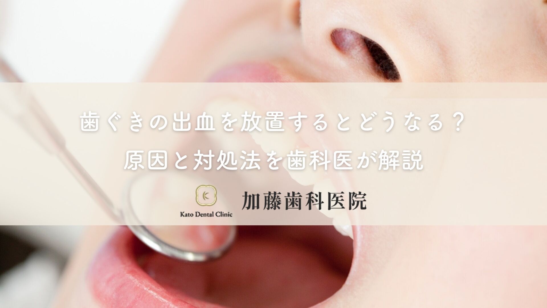 歯ぐきの出血を放置するとどうなる？原因と対処法を歯科医が解説｜各務原市